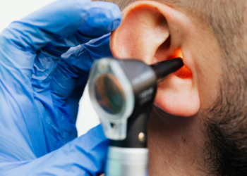 can you put peroxide in your ear