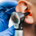 can you put peroxide in your ear