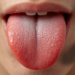 how to remove white tongue